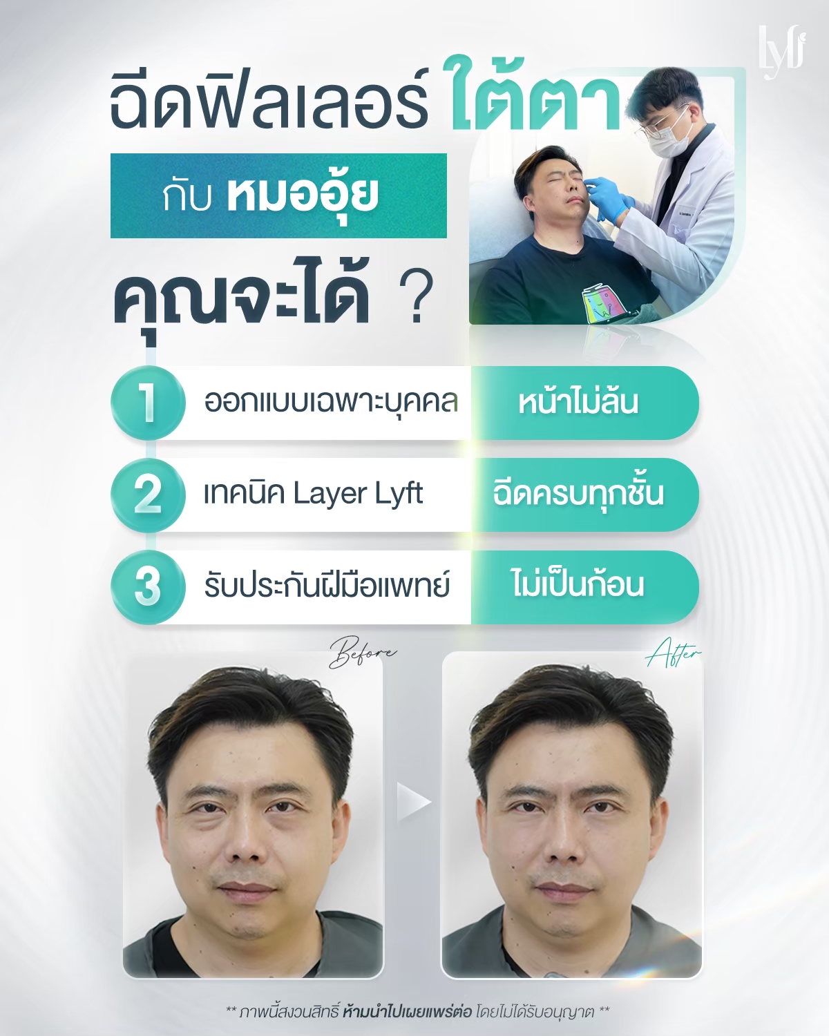 ตัวอย่างวีดิโอจาก Youtube<br>โดยเลือกภาพปกและลิงค์ youtube เองได้