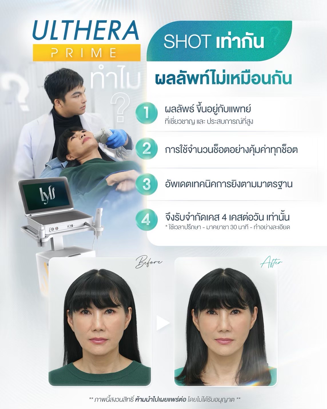 ตัวอย่างวีดิโอจาก Youtube<br>โดยเลือกภาพปกและลิงค์ youtube เองได้